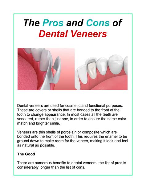 Composite Veneers Pros & Cons, Procedure, Cost, and Alternatives.